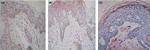 Estrogen Receptor beta Antibody in Immunohistochemistry (IHC)
