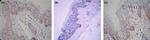 Estrogen Receptor beta Antibody in Immunohistochemistry (IHC)