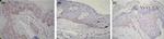 Estrogen Receptor beta Antibody in Immunohistochemistry (IHC)