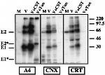 Calreticulin Antibody in Immunoprecipitation (IP)