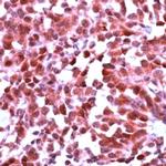 mGluR1 Antibody in Immunohistochemistry (IHC)