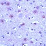 mGluR5 Antibody in Immunohistochemistry (IHC)