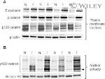 delta Catenin Antibody in Western Blot (WB)