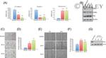 Fibronectin Antibody in Western Blot (WB)