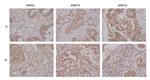ADAMTS8 Antibody in Immunohistochemistry (IHC)