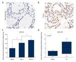 SMYD2 Antibody in Immunohistochemistry (IHC)