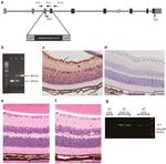CRALBP Antibody in Immunohistochemistry (IHC)