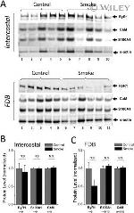 RyR1 Antibody in Western Blot (WB)