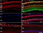 SERCA3 ATPase Antibody in Immunohistochemistry (IHC)