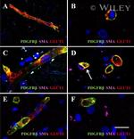 GLUT1 Antibody in Immunohistochemistry (IHC)