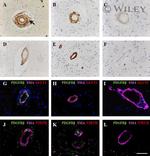 GLUT1 Antibody in Immunohistochemistry (IHC)