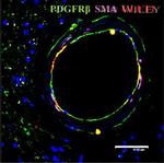 GLUT1 Antibody in Immunohistochemistry (IHC)