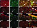 GFAP Antibody in Immunohistochemistry (Paraffin) (IHC (P))