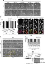 c-Myc Antibody in Immunocytochemistry (ICC/IF)