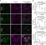 beta Amyloid Antibody in Immunohistochemistry - Free Floating (IHC (Free))