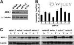 Metadherin Antibody in Western Blot (WB)