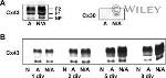 Connexin 30 Antibody in Western Blot (WB)