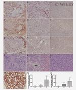 ACTA2 (smooth muscle actin alpha, SMA) Antibody in Immunohistochemistry (IHC)