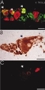 HuC/HuD Antibody in Immunohistochemistry (IHC)