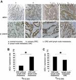 Metadherin Antibody in Immunohistochemistry (IHC)