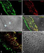 Connexin 26 Antibody in Immunohistochemistry (IHC)
