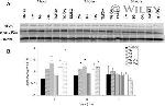Phospho-EIF2S1 (Ser52) Antibody in Western Blot (WB)
