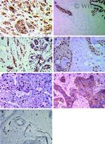 E-cadherin Antibody in Immunohistochemistry (Paraffin) (IHC (P))