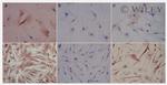 ACTA2 (smooth muscle actin alpha, SMA) Antibody in Immunohistochemistry (IHC)