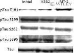 Tau Antibody in Western Blot (WB)