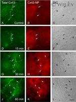 Connexin 43 Antibody in Immunocytochemistry (ICC/IF)