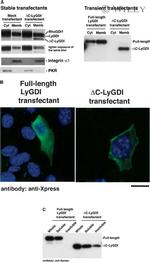 Xpress Antibody in Western Blot (WB)
