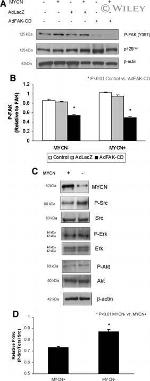 Phospho-SRC (Tyr419) Antibody in Western Blot (WB)