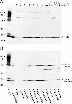 Connexin 26 Antibody in Western Blot (WB)
