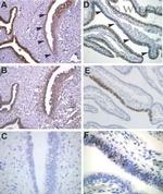 PAX2 Antibody in Immunohistochemistry (Paraffin) (IHC (P))