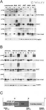 pan Synuclein Antibody in Western Blot (WB)