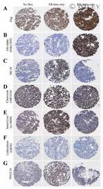 Estrogen Receptor beta Antibody in Immunohistochemistry (Paraffin) (IHC (P))