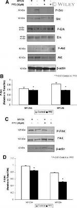 Phospho-SRC (Tyr419) Antibody in Western Blot (WB)