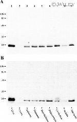 Connexin 26 Antibody in Western Blot (WB)