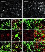 Connexin 30 Antibody in Immunohistochemistry (IHC)