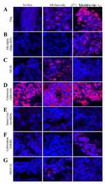 Estrogen Receptor beta Antibody in Immunohistochemistry (Paraffin) (IHC (P))
