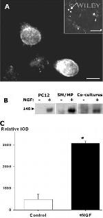 HuC/HuD Antibody in Immunocytochemistry (ICC/IF)