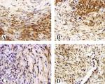 N-cadherin Antibody in Immunohistochemistry (IHC)