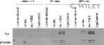Tau Antibody in Western Blot (WB)