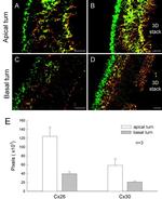 Connexin 26 Antibody in Immunohistochemistry (IHC)