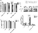 Tau Antibody in Western Blot (WB)