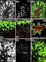 PAX2 Antibody in Immunohistochemistry (IHC)