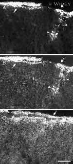 Connexin 30 Antibody in Immunohistochemistry (IHC)