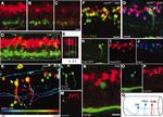 PAX2 Antibody in Immunohistochemistry (IHC)