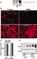 Connexin 30 Antibody in Western Blot (WB)