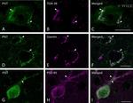 PSD-95 Antibody in Immunohistochemistry (IHC)